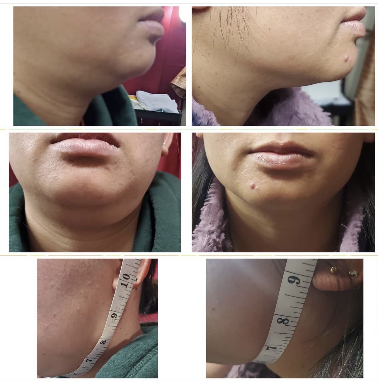 Before and after cosmetic treatment results